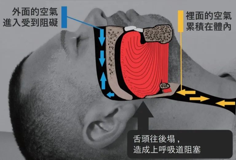 通過這樣訓練就能(néng)改善睡覺打呼噜（轉給需要的...）